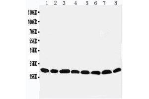 Western Blotting (WB) image for anti-Peroxiredoxin 5 (PRDX5) (AA 166-181), (C-Term) antibody (ABIN3044202) (Peroxiredoxin 5 anticorps  (C-Term))