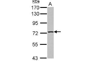 Western Blotting (WB) image for anti-TBC1 Domain Family, Member 15 (TBC1D15) (N-Term) antibody (ABIN1494104) (TBC1D15 anticorps  (N-Term))