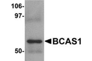 Western blot analysis of BCAS1 in human lung tissue lysate with BCAS1 antibody at 1 μg/ml. (BCAS1 anticorps  (C-Term))
