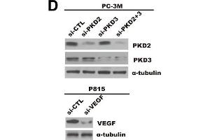 Prostate cancer cells-derived PKD2/3 promote chemotactic migration of mast cells and endothelial cells tube formation. (VEGFA anticorps  (AA 27-126))