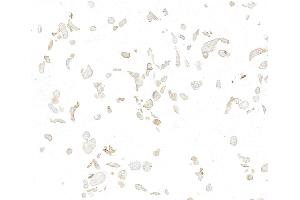Immunocytochemistry (ICC) image for anti-Met Proto-Oncogene (MET) (C-Term) antibody (ABIN7795683) (Recombinant c-MET anticorps  (C-Term))