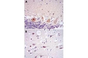 Immunohistochemical analysis of paraffin-embedded human cerebellum tissues (A) and brain tissues (B) using CDK5 monoclonal antibody, clone 4E4  with DAB staining. (CDK5 anticorps)