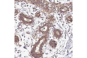 Immunohistochemical staining of human breast with OAS3 polyclonal antibody  shows moderate cytoplasmic positivity in glandular cells at 1:500-1:1000 dilution.