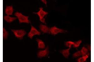 ABIN6275648 staining HeLa by IF/ICC. (PTPN22 anticorps  (C-Term))