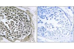 Immunohistochemistry analysis of paraffin-embedded human testis tissue, using GIDRP88 Antibody. (GIDRP88 anticorps  (AA 721-770))