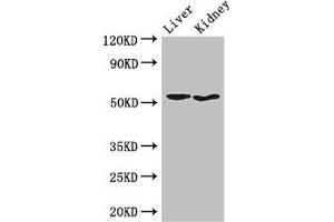 Western Blot Positive WB detected in: Mouse liver tissue, Mouse kidney tissue All lanes: SNX17 antibody at 3. (SNX17 anticorps  (AA 280-457))