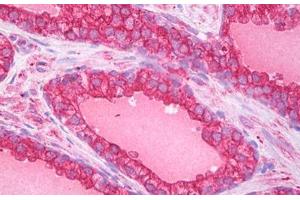 Anti-ATG5 antibody IHC staining of human prostate.