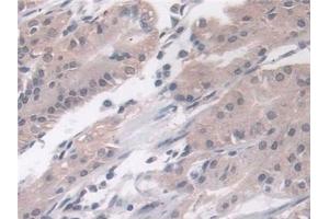 Detection of PLD in Human Stomach Tissue using Polyclonal Antibody to Phospholipase D (PLD)