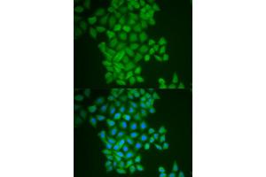 Immunofluorescence analysis of MCF-7 cell using FTH1 antibody. (FTH1 anticorps)