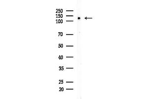 anti-MutS Homolog 3 (MSH3) (N-Term) antibody