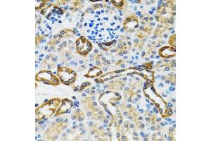 Immunohistochemistry of paraffin-embedded rat kidney using CASP3 antibody. (Caspase 3 anticorps)
