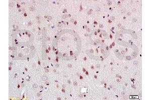 Formalin-fixed and paraffin embedded rat brain tissue labeled with Anti-PEG3 Polyclonal Antibody, Unconjugated (ABIN735653) at 1:200 followed by conjugation to the secondary antibody and DAB staining (PEG3 anticorps  (AA 1501-1588))
