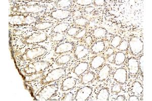 Formalin-fixed and paraffin embedded rat colon labeled with Anti-TGF alpha Polyclonal Antibody Unconjugated (ABIN724415) followed by conjugation to the secondary antibody and DAB staining