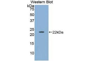 Western Blotting (WB) image for anti-Histone Acetyltransferase 1 (HAT1) (AA 100-338) antibody (ABIN1859122) (HAT1 anticorps  (AA 100-338))