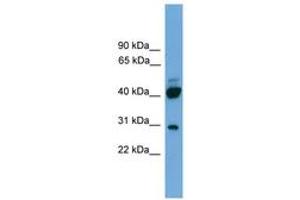 Image no. 1 for anti-Proline Rich 5 (Renal) (PRR5) (AA 35-84) antibody (ABIN6746469) (PRR5 anticorps  (AA 35-84))