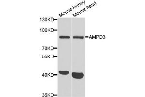 Western blot analysis of extracts of various cell lines, using AMPD3 antibody (ABIN5973764) at 1/1000 dilution.