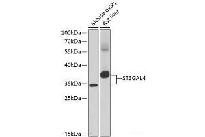 Western blot analysis of extracts of various cell lines using ST3GAL4 Polyclonal Antibody at dilution of 1:1000. (ST3GAL4 anticorps)