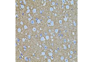 Immunohistochemistry of paraffin-embedded mouse brain using STX1A antibody (ABIN5995405) (40x lens).