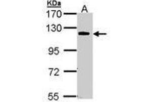 Image no. 1 for anti-Caspase Recruitment Domain Family, Member 10 (CARD10) (AA 341-600) antibody (ABIN467541) (CARD10 anticorps  (AA 341-600))