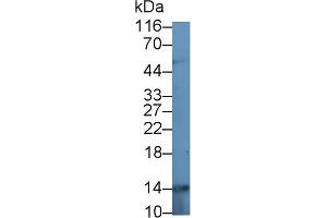 Detection of CALPRO in Human Saliva using Polyclonal Antibody to Calprotectin (CALPRO) (S100A8/A9 Complex (Calprotectin) anticorps  (AA 1-114))
