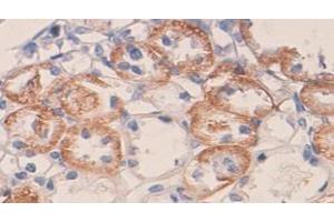 IHC staining of formalin-fixed paraffin-embedded rat kidney with VEGF protein staining, using VEGF antibody (1/100 dilution).