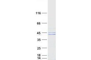 Validation with Western Blot