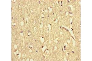 Immunohistochemistry of paraffin-embedded human brain tissue using ABIN7175867 at dilution of 1:100