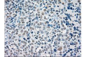Immunohistochemical staining of paraffin-embedded colon tissue using anti-STK3mouse monoclonal antibody.