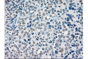 Immunohistochemical staining of paraffin-embedded colon tissue using anti-STK3mouse monoclonal antibody. (STK3 anticorps)