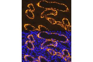 Immunofluorescence analysis of rat kidney using PDZK1 Rabbit mAb (ABIN7269199) at dilution of 1:100 (40x lens). (PDZK1 anticorps)