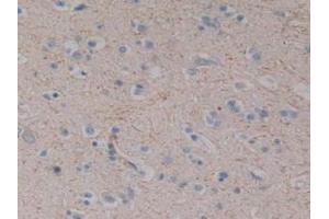 Detection of SP in Human Brain Tissue using Polyclonal Antibody to Substance P (SP)