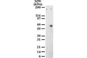 Image no. 1 for anti-Activating Transcription Factor 2 (ATF2) (pThr71) antibody (ABIN208166) (ATF2 anticorps  (pThr71))