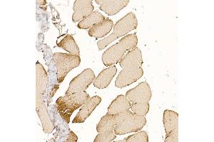 Immunohistochemistry of paraffin-embedded rat skeletal muscle using CLCN1 Rabbit pAb (ABIN6130939, ABIN6138661, ABIN6138662 and ABIN6221409) at dilution of 1:200 (40x lens).