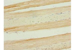 Immunohistochemistry of paraffin-embedded human skeletal muscle tissue using ABIN7159666 at dilution of 1:100