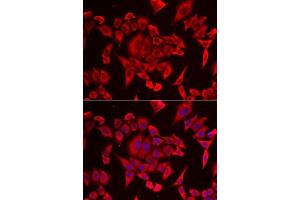 Immunofluorescence analysis of HeLa cells using SLC20A2 antibody.