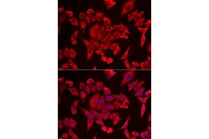 Immunofluorescence analysis of HeLa cells using SLC20A2 antibody. (SLC20A2 anticorps  (AA 235-485))