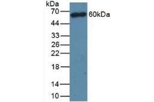 Detection of CD4 in Mouse Thymus Tissue using Polyclonal Antibody to Cluster Of Differentiation 4 (CD4) (CD4 anticorps  (AA 27-394))