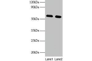 Western blot All lanes: PHGDH antibody at 2 μg/mL Lane 1: EC109 whole cell lysate Lane 2: 293T whole cell lysate Secondary Goat polyclonal to rabbit IgG at 1/15000 dilution Predicted band size: 57 kDa Observed band size: 57 kDa (PHGDH anticorps  (AA 2-251))