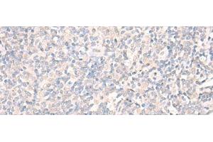 Immunohistochemistry of paraffin-embedded Human tonsil tissue using LILRA2 Polyclonal Antibody at dilution of 1:40(x200) (LILRA2 anticorps)