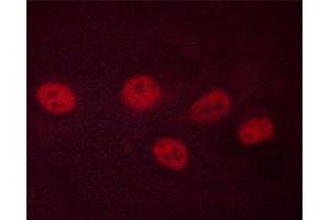 ABIN6267399 staining SK-N-MC cells treated forskolin and FGF by ICC/IF. (CREB1 anticorps  (pSer142))