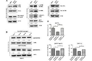 HDAC2 positively regulates the expression of p-Akt, p-mTOR, and survivin in ER+ breast cancer cells.