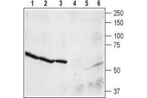 Western blot analysis of rat brain membrane (lanes 1 and 4), cortex (lanes 2 and 5), and hippocampus (lanes 3 and 6) lysates: - 1,2,3. (NPY4R anticorps  (C-Term, Intracellular))
