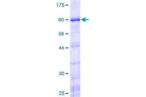 Image no. 1 for Y Box Binding Protein 1 (YBX1) (AA 1-324) protein (GST tag) (ABIN1325506)