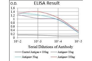 Black line: Control Antigen (100 ng), Purple line: Antigen(10 ng), Blue line: Antigen (50 ng), Red line: Antigen (100 ng),