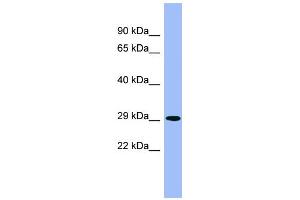 WB Suggested Anti-PHYH Antibody Titration: 0. (PHYH anticorps  (Middle Region))