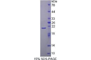 SDS-PAGE analysis of Mouse CAPN1 Protein. (CAPNL1 Protéine)
