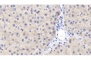 Detection of REV1 in Human Liver Tissue using Polyclonal Antibody to REV1 Homolog (REV1) (REV1 anticorps  (AA 834-976))