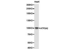 Western Blotting (WB) image for anti-ATPase, Ca++ Transporting, Cardiac Muscle, Slow Twitch 2 (ATP2A2) antibody (ABIN1871156)