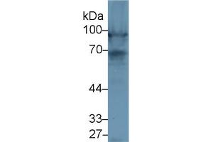Western Blot; Sample: Rat Heart lysate; Primary Ab: 1µg/ml Rabbit Anti-Rat NEXN Antibody Second Ab: 0. (NEXN anticorps  (AA 214-455))