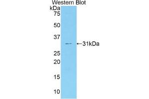 Western blot analysis of the recombinant protein. (Coagulation Factor V anticorps  (AA 364-611))